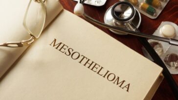 mesothelioma-stages