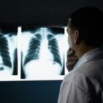 mesothelioma-symptoms